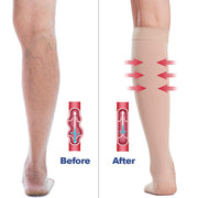 Open Toe Knee High Calf Compression Socks