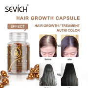 Castor Oil Keratin Complex Hair Vitamin Capsule Hair Regrowth Treatment