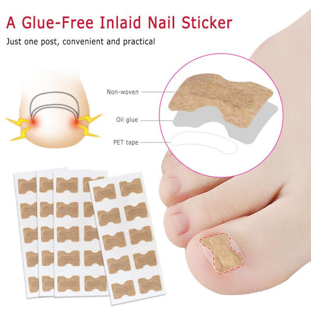 1/5pc Toe sticker Nail Strips Anti-roll Nail Glue Toe Inlay Nail Corrector