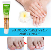 20g Nail Cream Fungus Treatment Cream Removal Nail Paronychia Ointment Feet Whitening