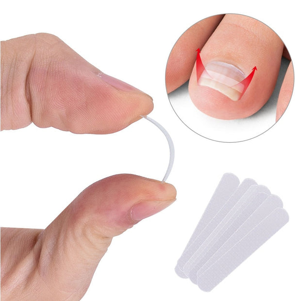 10pcs Ingrown Toenail Correction Tool Ingrown Toe Nail Treatment