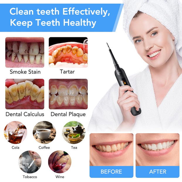 LED Electric Sonic Scaler Toothbrush Set Stains Dental Calculus Remover