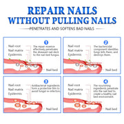Jemeesen Fungal Nail Treatment Oil Foot Repair Essence