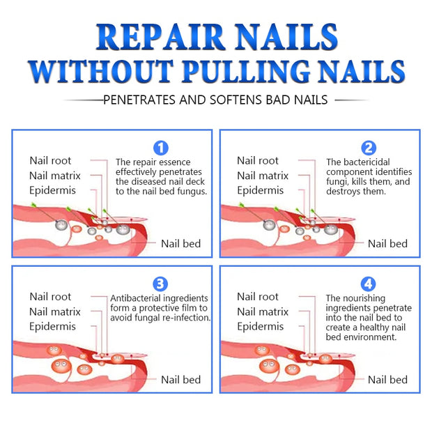Jemeesen Fungal Nail Treatment Oil Foot Repair Essence