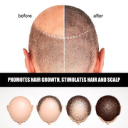 5pcs Hair Growth Ampoule Serum Hair Nourishing Growth Liquid Bald Scalp Treatment