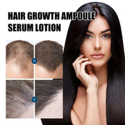 5pcs Hair Growth Ampoule Serum Hair Nourishing Growth Liquid Bald Scalp Treatment