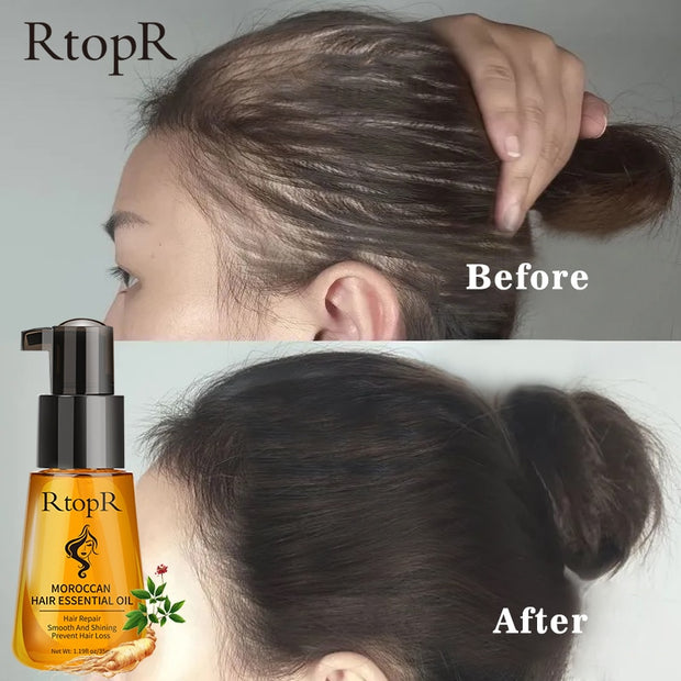 Moroccan Prevent Hair Loss Product Hair Growth Essential Oil