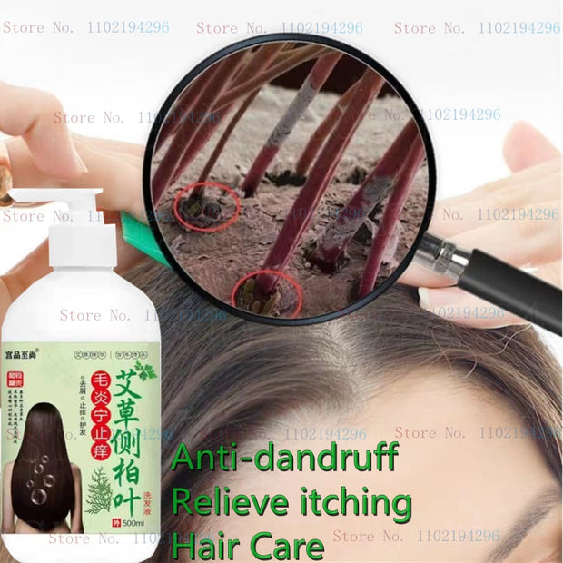 Relieve Scalp Folliculitis, Dandruff, Itching, Oil Control, Remove Mites, Seborrheic Scalp Pustules, Shampoo