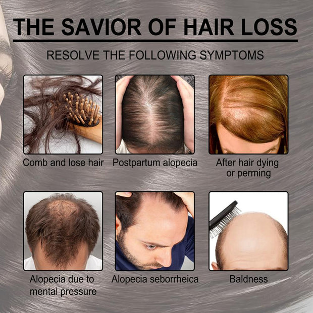 Hair Growth Essential Oil Repair Damaged Beauty Hair Care Prevent Hair Loss Serum